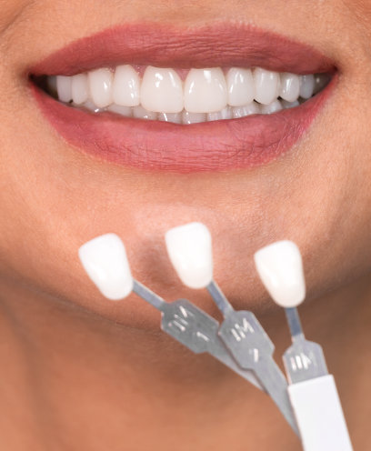 Get an even, symmetrical smile with our porcelain veneers. 