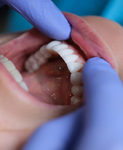 Protect the health of your smile with regular cleanings. 