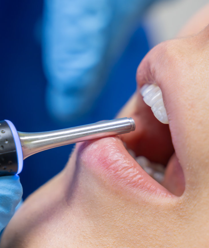 What is air-powered tooth polishing?