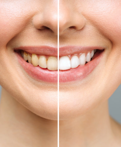 See real patient results from their orthodontic and dental treatments.