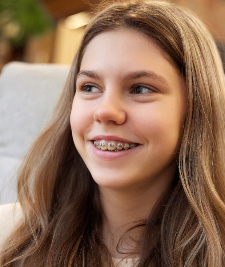 How do fixed braces work?