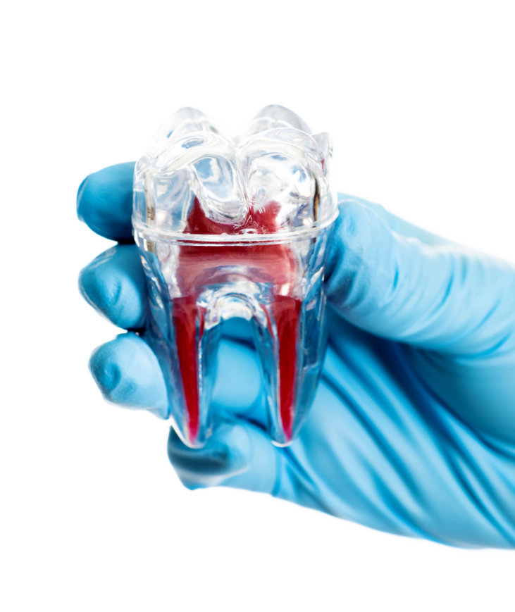 What causes pulp damage?