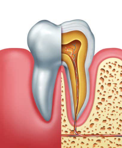 Get relief for a painful or damaged tooth with a root canal treatment. 