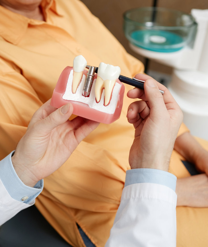 What to expect from single tooth dental implant treatment