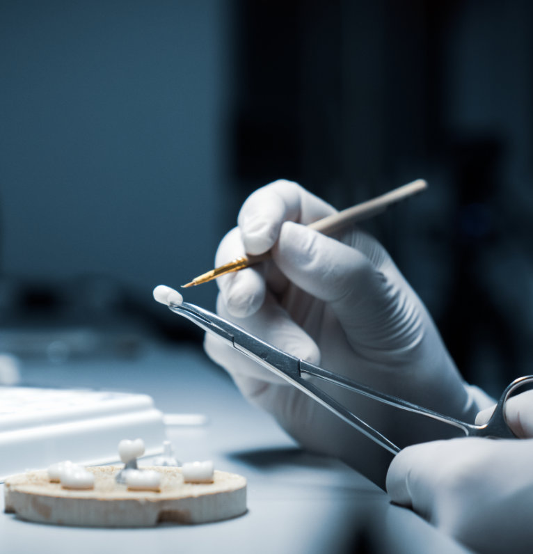 Advanced ceramic bridges at Stoke Bishop