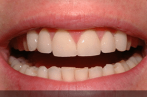 After - Stoke Bishop Dental Centre