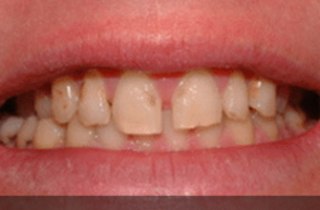 Before - Stoke Bishop Dental Centre