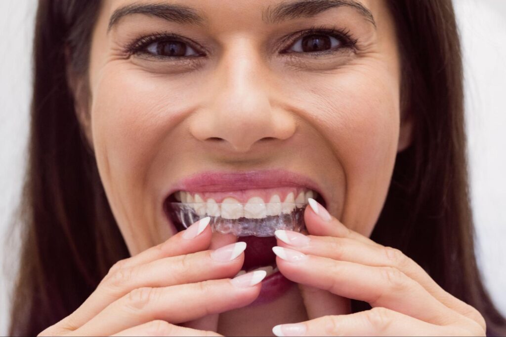 woman putting in aligners