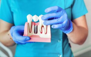 dentist showing a tooth model of dental implants